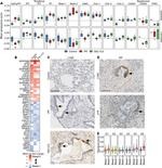 LY6D Antibody in Immunohistochemistry (IHC)