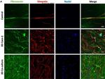 Mouse IgG (H+L) Cross-Adsorbed Secondary Antibody in Immunocytochemistry (ICC/IF)