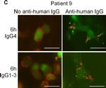 Human IgG (H+L) Cross-Adsorbed Secondary Antibody in Immunocytochemistry (ICC/IF)