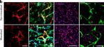 Rabbit IgG (H+L) Cross-Adsorbed Secondary Antibody in Immunocytochemistry (ICC/IF)