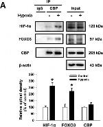 Rabbit IgG (H+L) Secondary Antibody in Western Blot (WB)