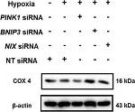 Mouse IgG (H+L) Secondary Antibody in Western Blot (WB)