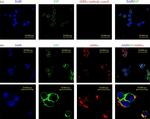 Rabbit IgG (H+L) Highly Cross-Adsorbed Secondary Antibody in Immunocytochemistry (ICC/IF)