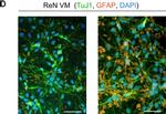 Rabbit IgG (H+L) Cross-Adsorbed Secondary Antibody in Immunocytochemistry (ICC/IF)