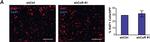 Rabbit IgG (H+L) Cross-Adsorbed Secondary Antibody in Immunohistochemistry (IHC)