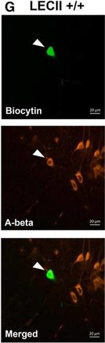 Mouse IgG (H+L) Cross-Adsorbed Secondary Antibody in Immunocytochemistry (ICC/IF)