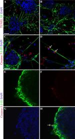 Rabbit IgG (H+L) Cross-Adsorbed Secondary Antibody in Immunohistochemistry (PFA fixed) (IHC (PFA))