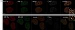 Rabbit IgG (H+L) Cross-Adsorbed Secondary Antibody in Immunocytochemistry (ICC/IF)