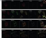 Rabbit IgG (H+L) Cross-Adsorbed Secondary Antibody in Immunocytochemistry (ICC/IF)