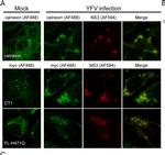 Rabbit IgG (H+L) Cross-Adsorbed Secondary Antibody in Immunocytochemistry (ICC/IF)