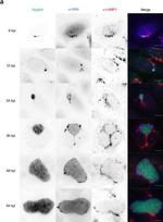 Rabbit IgG (H+L) Cross-Adsorbed Secondary Antibody in Immunocytochemistry (ICC/IF)