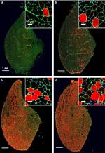 Rabbit IgG (H+L) Highly Cross-Adsorbed Secondary Antibody in Immunohistochemistry (IHC)