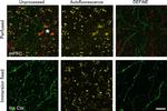 Rabbit IgG (H+L) Highly Cross-Adsorbed Secondary Antibody in Immunohistochemistry (IHC)