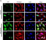 Rabbit IgG (H+L) Highly Cross-Adsorbed Secondary Antibody in Immunocytochemistry (ICC/IF)