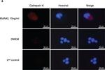 Goat IgG (H+L) Cross-Adsorbed Secondary Antibody in Immunocytochemistry (ICC/IF)