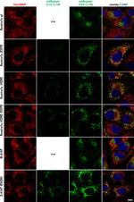 Rabbit IgG (H+L) Highly Cross-Adsorbed Secondary Antibody in Immunocytochemistry (ICC/IF)