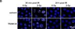 Mouse IgG1 Cross-Adsorbed Secondary Antibody in Immunocytochemistry (ICC/IF)