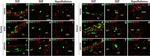 Mouse IgG (H+L) Highly Cross-Adsorbed Secondary Antibody in Immunohistochemistry (IHC)