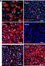 Rabbit IgG (H+L) Highly Cross-Adsorbed Secondary Antibody in Immunocytochemistry (ICC/IF)