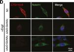 Mouse IgM (Heavy chain) Cross-Adsorbed Secondary Antibody in Immunocytochemistry (ICC/IF)