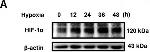 Mouse IgG (H+L) Secondary Antibody in Western Blot (WB)