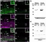 CaMKII beta Antibody