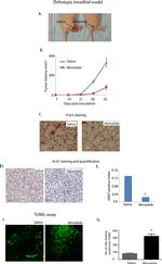 Ki-67 Antibody