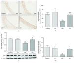 GLO1 Antibody