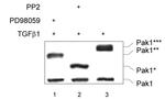 PAK1 Antibody