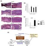 VEGF Antibody