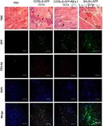 CD3 Antibody in Immunohistochemistry (IHC)