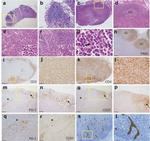 CD4 Antibody in Immunohistochemistry (Paraffin) (IHC (P))