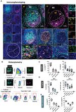 CD20 Antibody in Immunohistochemistry (IHC)