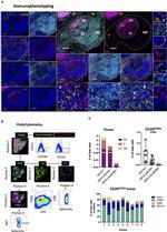 CD20 Antibody in Immunohistochemistry (IHC)