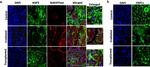 Aquaporin 5 Antibody in Immunohistochemistry (IHC)