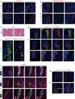 LYVE1 Antibody in Immunocytochemistry (ICC/IF)