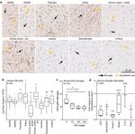 CD45 Antibody in Immunohistochemistry (IHC)