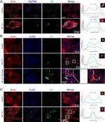 CD282 (TLR2) Antibody in Immunocytochemistry (ICC/IF)