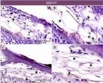 CD117 (c-Kit) Antibody in Immunohistochemistry (IHC)