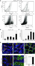 CD140a (PDGFRA) Antibody in Immunohistochemistry (IHC)