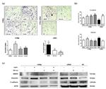 CD324 (E-Cadherin) Antibody in Western Blot (WB)