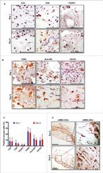 FOXP3 Antibody in Immunohistochemistry (IHC)