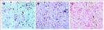 FOXP3 Antibody in Immunohistochemistry (IHC)