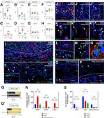 IBA1 Antibody in Immunohistochemistry (Frozen) (IHC (F))