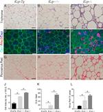 Galectin 3 Antibody in Immunohistochemistry (IHC)