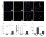 Galectin 3 Antibody in Immunohistochemistry (IHC)