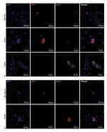 Galectin 3 Antibody in Immunohistochemistry (IHC)