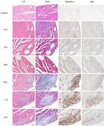 Galectin 3 Antibody in Immunohistochemistry (IHC)