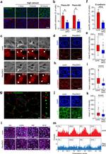 alpha Catenin Antibody in Immunocytochemistry (ICC/IF)