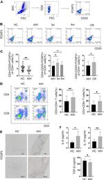 FOXP3 Antibody in Immunohistochemistry (IHC)